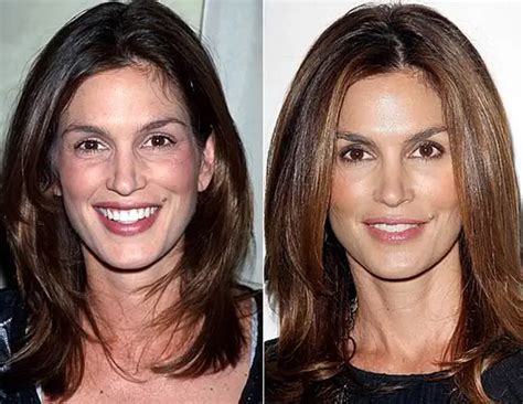 Cindy Crawford Nose Job Plastic Surgery Before and。